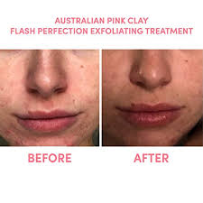 Sand & sky respectfully acknowledges the traditional owners of the land on which we operate, the boon wurrung and woiwurrung (wurundjeri) peoples of the kulin nation, and their connections to land, sea and community. Sand Sky Perfect Skin Bundle 2 In 1 Australian Pink Clay Face Mask Set Pink Clay Face Scrub Exfoliator Pore Cleaner Facial Cleanser Gift Sets For Women Pricepulse