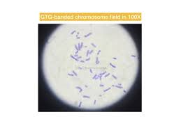 Pin On Genetic Education