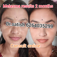 Dr-satish Nayak Patidar