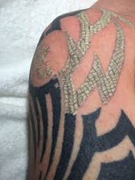 Keep it clean and use an. 10 Side Effects Of Laser Tattoo Removal What You Should Know