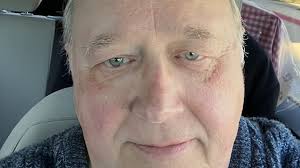 Fundraiser by kate bailey : Please help Grace have her knee repaired.