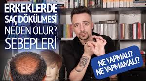 Erkeklerde Sac Dokulmesinin Sebepleri Nasil Onlenir Sac Dokulmesini Engelleme Youtube