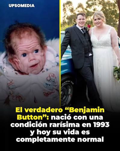 En una sala de hospital en Australia, en 1993, un recién nacido llamó la  atención de todos por una razón inesperada. Su nombre era Tomm Tennent.  Nació con una condición extremadamente rara