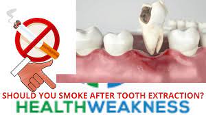 Smoking damages blood vessels and can make them thicken and grow narrower. Must You Smoke After Tooth Extraction Read This First Healthweakness