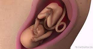Die leichten schmerzen können sowohl mit dem darm als auch mit der blase. 26 Schwangerschaftswoche Das Tut Sich In Der 26 Ssw Netdoktor