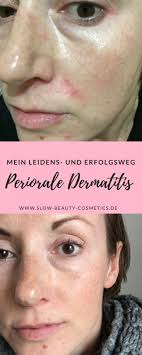 Es gibt 3 verschiedene formen ✔ ursachen, symptome, behandlung wissen rund um ekzeme. Periorale Dermatitis Hautpflege Ernahrung Make Up Slow Beauty Gesicht Pflege Haut Unreine Haut