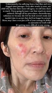 It's getting more difficult to stay strong." Ito ang pahayag ng 'Queen of  All Media' na si Kris Aquino sa mga pinagdadaanan niyang sakit ngayon. Sa  latest update niya sa kanyang Instagram,