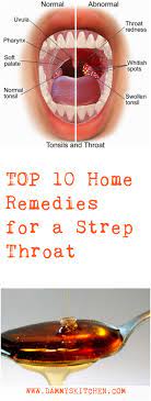 Strep Throat 10 Natural Remedies Health Remedies Nature Healthylife Natural Health Tips Remedies Natural Health Remedies