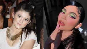 Kylie jenner was born in 1997 in california. Kylie Jenner Cumple 22 Asi Es Su Aspecto Despues De Innumerables Operaciones