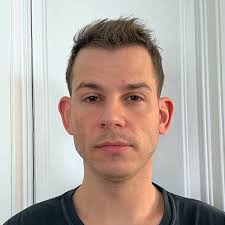 Haartransplantation von Max "MaxaMillion"