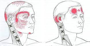 Check spelling or type a new query. Toothache And Muscle Pain Treatment Tmj Tooth Pain Carolina Tmj