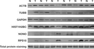 Total Protein Normalization Lsr Bio Rad