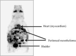 Understanding what is involved in the mesothelioma claims process and knowing the deadlines for each type of case will help you ensure that you get the compensation you deserve. Imaging In Pleural Mesothelioma A Review Of The 14th International Conference Of The International Mesothelioma Interest Group Lung Cancer