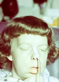 NMO and Other Antibody-Mediated Neurological Diseases Angela Vincent and  the Neurosciences Group Nuffield Department of Clinical