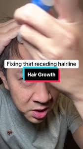 Jonathan Le Dr Ribeyes