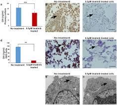 But, no matter what type of diabetes you have, it can. Frontiers Imatinib Inhibits Gh Secretion From Somatotropinomas Endocrinology