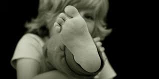 Analisis cairan persendian untuk memeriksa apakah nyeri yang muncul diakibatkan oleh infeksi atau kristal asam urat. Cara Mendeteksi Dini Anak Terkena Kaki X Dan O Feed Merdeka Com