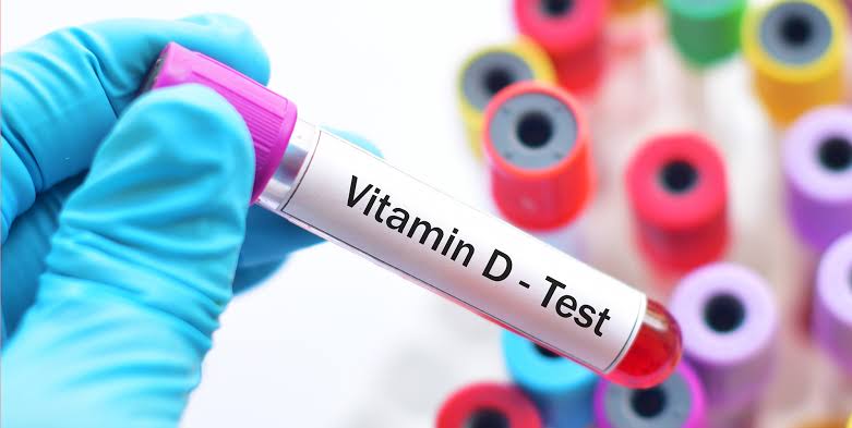 Vitamin D Testing | Canton, OH | Periodontal & Implant Care