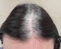 Dyeing gray hair is a serious commitment, especially if you deal with early graying. Gray Hair Color Dark Roots Novocom Top