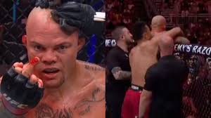 Anthony Smith Explains Angry Gesture At Fan After Dominant Loss In UFC  Kansas City Retirement Fight