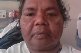 Commonwealth calls for intervention to free terminally ill Indigenous man