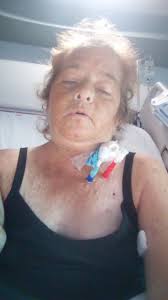 recurring infections with dialysis catheter