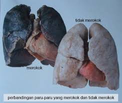 Orang yang menjalankan usaha atau perusahaan dengan kemungkinan untung atau rugi. Dinas Kesehatan Provinsi Banten Pengertian Merokok Dan Akibatnya