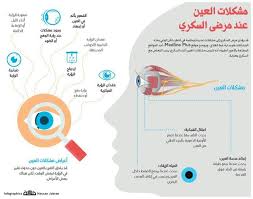 مشكلات العين عند مرضى السكري Map Places To Visit Visiting