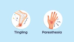 Image result for Paresthesia