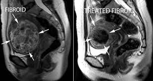 Module 5 Pelvis Imaging