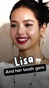 ฟันเพชรลิซ่า: ดึงดูดทุกสายตาด้วยรอยยิ้ม