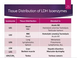 Electrophoresis Of Ldh Isoenzymes And Activity Staining