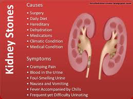 Pin By Special Needs Neuro Neurodevel On Health Nutrition And Beauty Nursing Mnemonics Infographic Health Kidney Health