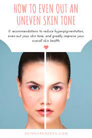 11 Tips To Even Out An Uneven Skin Tone In 2021 Uneven Skin Tone Skin Tones Uneven Skin