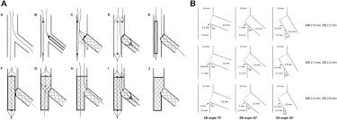 I do want to tell you that you don't need a national holiday to tell your crush about how you feel. Double Kissing Nanocrush For Bifurcation Lesions Development Bioengineering Fluid Dynamics And Initial Clinical Testing Sciencedirect