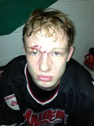 Petition · Canadian Lacrosse Association: Repeal CLA Policy 12.4 &  Reinstate Previous Policy For Helmets & Facemasks