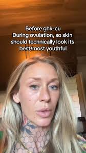 I guess I’m showing my peptide glow up journey?! , GHK-CU is known for  helping the body repair tissue, increase collagen and elastin production,  and even improve skin tone and hair growth from the ...