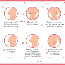 Preventing Breast Cancer Through Early Detection And Diagnosis