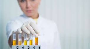 Pada 2013 diperkirakan bahwa lebih dari 382 juta orang di. Urine Penderita Diabetes Rasanya Manis