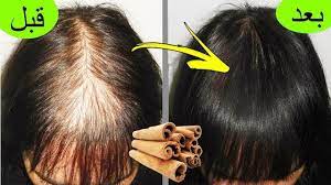 كنز في كل بيت ينبت الشعر في مقدمة الراس بسرعة والنتيجة مبهرة تعالج الصلع hair care oils long hair video treat hair fall