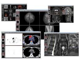 Maybe you would like to learn more about one of these? Dicom Viewer Radiant About Us
