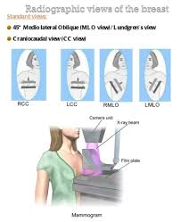 Pin By Amir Karkhi On Surgery Mammography Mammogram X Ray
