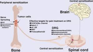 Image result for Cancer Pain