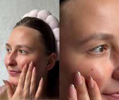 U tridesetima mi je koža postala suha i osjetljiva