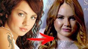 Черная полоса в жизни певицы началась уже давно. Shok Chto Sluchilos S Licom Pevicy Maksim Youtube