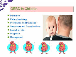 Image result for Pediatric Reflux