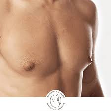 Dr Jeremy Hunt - Before And After Breast Reduction. Dr... | Facebook