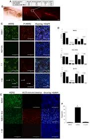 Inurl:login.php signup now to submit your own articles. Induction Of Phenotypic Changes In Her2 Postive Breast Cancer Cells In Vivo And In Vitro Oncotarget