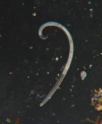 Horsehair worms and the grasshopper nematode parasite, mermis nigrescens, are both harmless to humans. The Story Behind These Ubiquitous Round Worms Juneau Empire