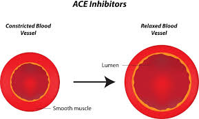 Image result for ACE Inhibitor